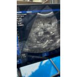 HASZNÁLT Vezeték nélküli konvex állatorvosi ultrahang - iOS és Android