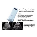   Vezeték nélküli állatorvosi ultrahang készülék - konvex 