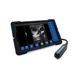 Wifi-s mobil ultrahang készülék - választható rektális vizsgálófejjel