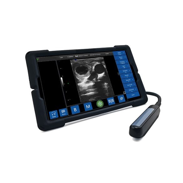 Wifi-s mobil ultrahang készülék - választható rektális vizsgálófejjel