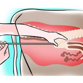 Inszeminálás, ultrahangos vizsgálat
